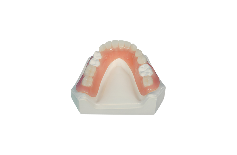 Acrylic Base Partial Denture